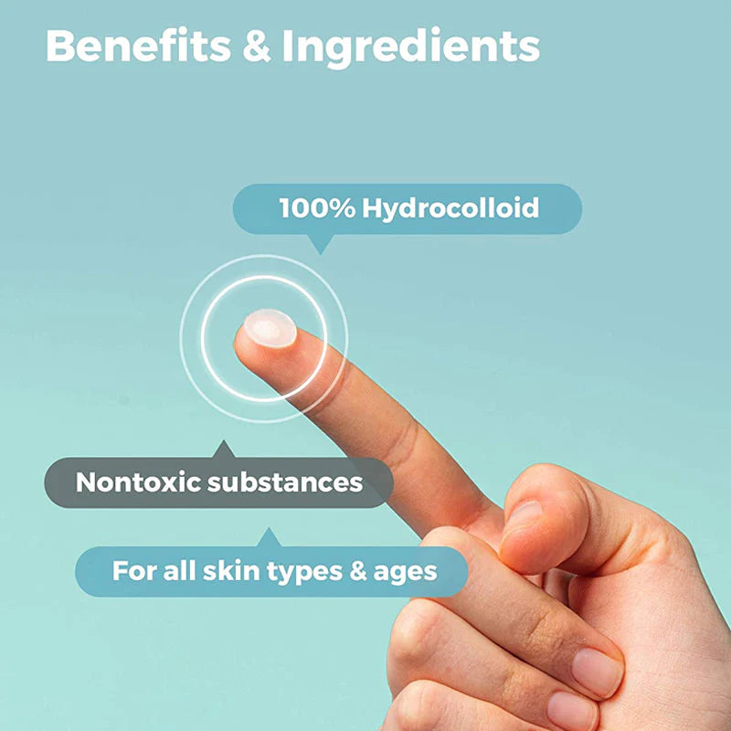 Acne Pimple Patches